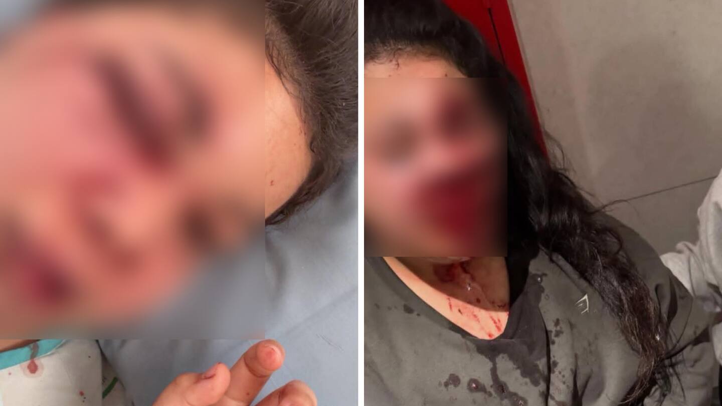 12355 | 奥克兰女子健身房内遭袭,重伤昏迷满脸是血,只记得自己喊了救命!
