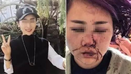 三问云南旅游乱象：如何看待？为啥总是云南？ 能怎么治？