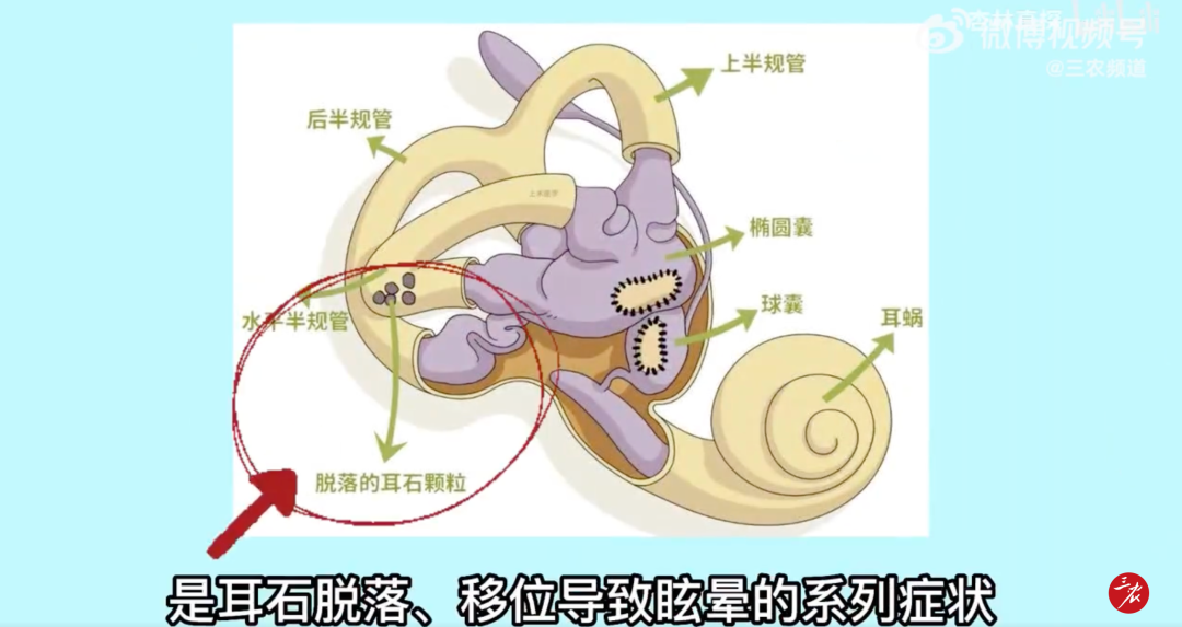 女歌手现场晕倒！这种病正“盯”上年轻人