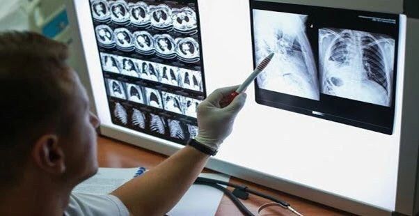 注意！心脏、嗅觉、睾丸受损…新冠的可怕后遗症正被人忽视！