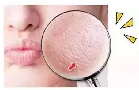 一个精致的女孩子，怎么可以有这么粗的毛孔