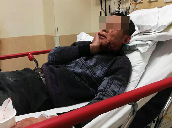 华人在奥克兰东区被莫名打到住院，警方对此事的态度却让人无语……