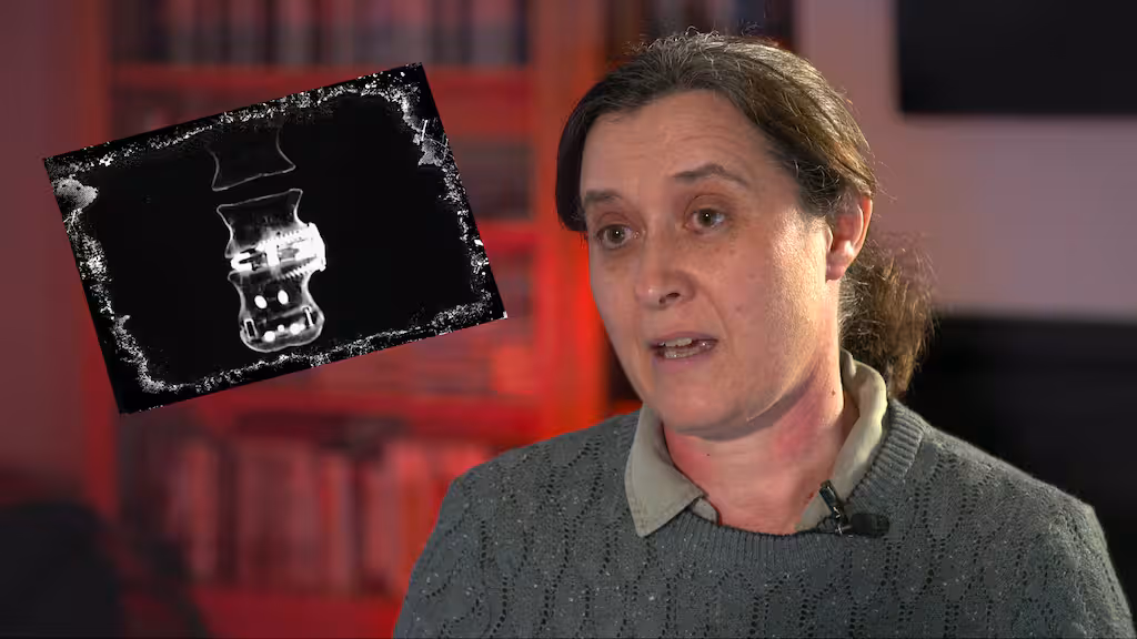 jacoba-vaessler-spinal-thumb-LOZQIBZOQNCPVPI3BM4GTUS7NE.jpg | 女患者脊柱手术螺钉安错了，忍痛两年求医无果，自费6万纽币赴澳手术