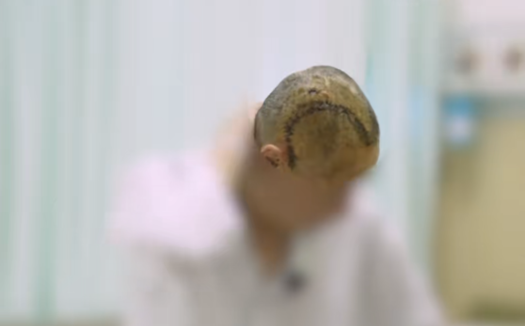 半边头骨摔碎!深圳男子洗澡时脚下一滑,头部重重撞向地面!这些细节很重要
