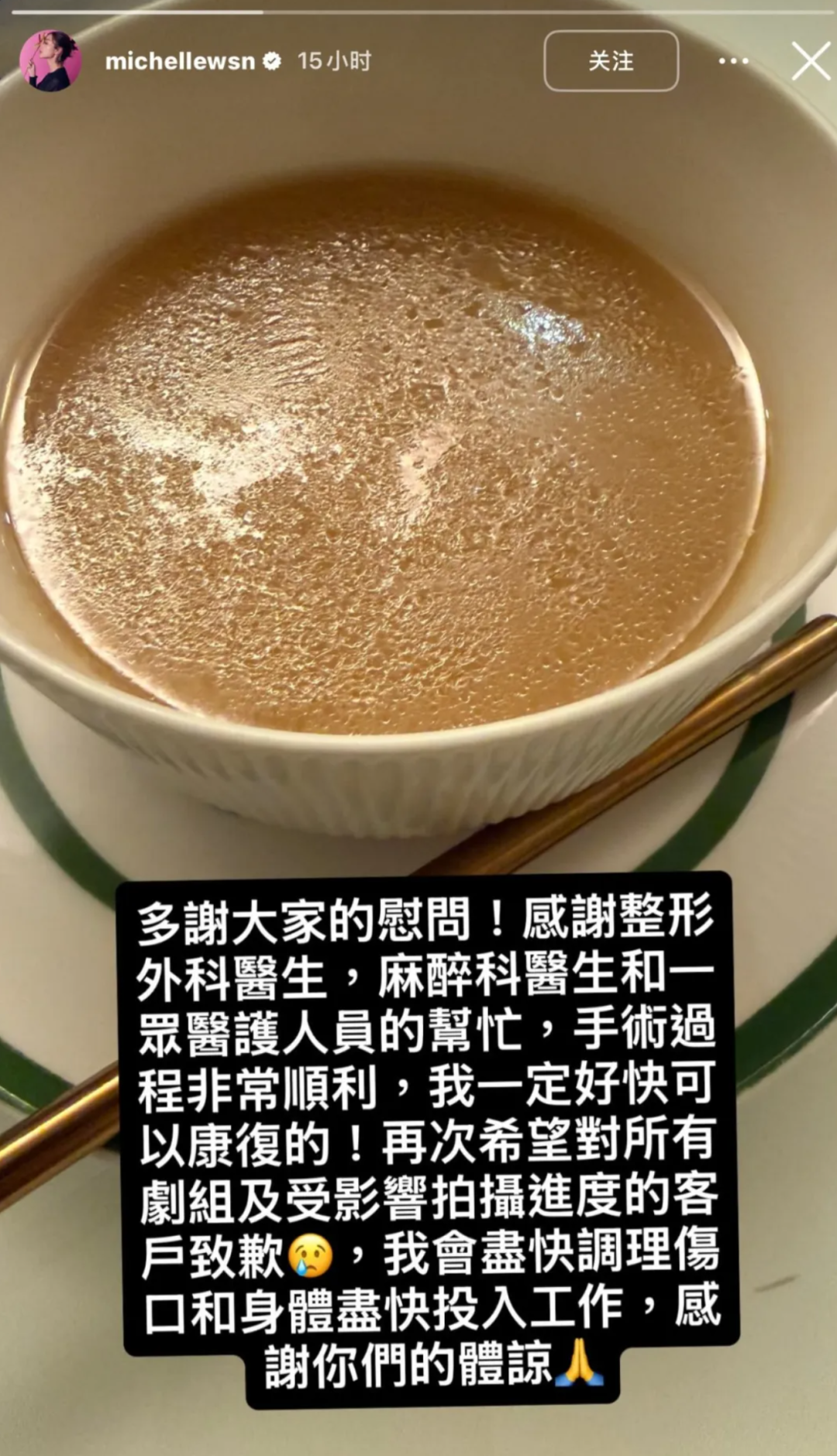 惊险! 华人女星拍戏时出意外 脸部缝50多针! 重伤后拿下影后 领奖不敢大笑!