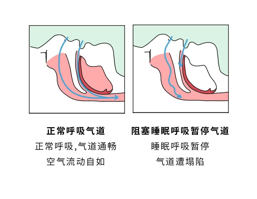 注意!经常做这一种梦,说明你的大脑正在退化!!