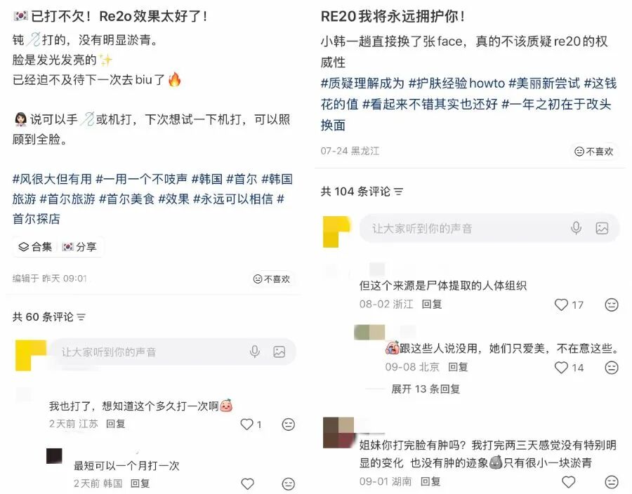 把死人皮肤组织打进活人脸里,韩国3000元一针“尸皮针”火了;消费者:打完才知道原材料来源于逝者;专家称若捐献者有遗传病会带来风险