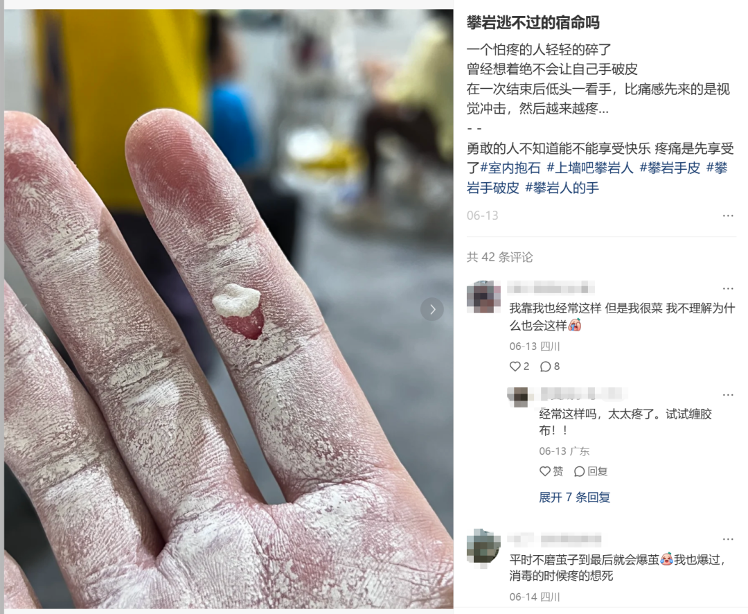 56岁大佬摔成粉碎性骨折,但这“危险运动”依然让有钱人打工人都上头