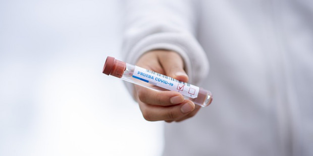 test tube 5065426 640 1