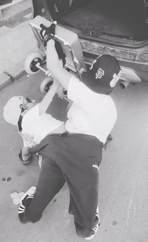 两颗心共用身体!网红连体兄弟离世:我们生而相伴,也将一同死去…