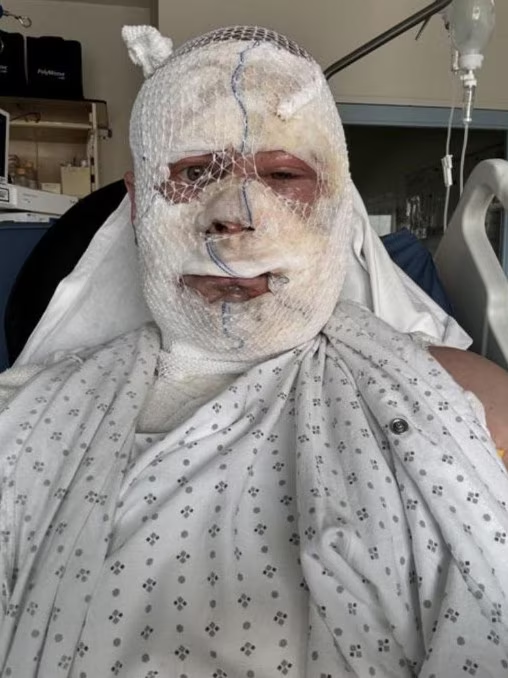 恐怖“情人劫”!澳华男闹分手,竟拿锅狠砸、开水猛泼伴侣!被控谋杀未遂