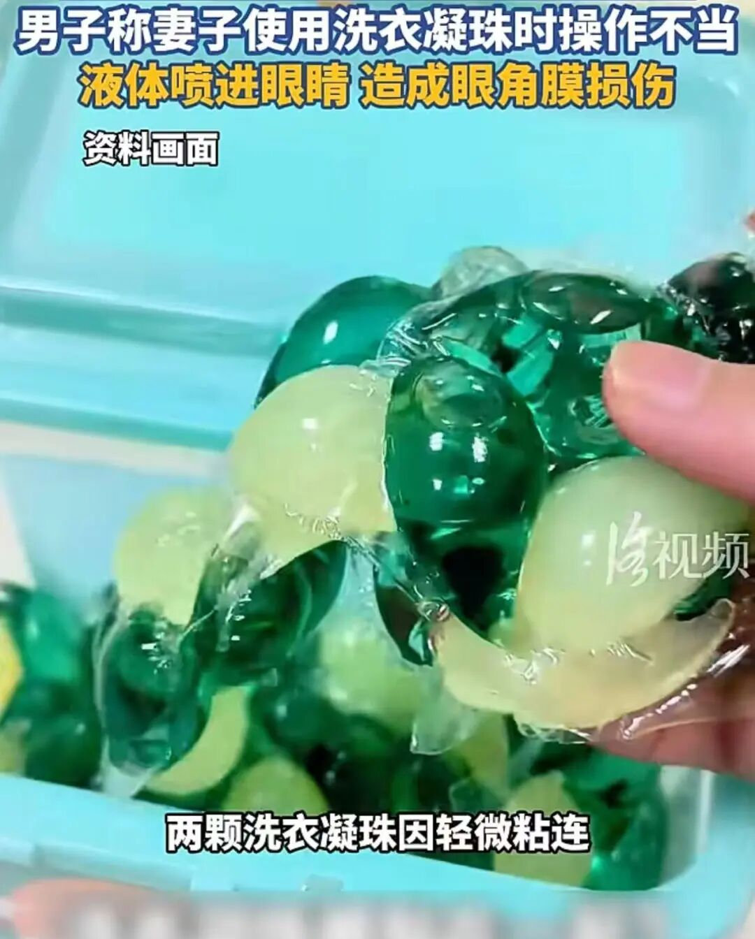 洗衣凝珠突然爆开,女子眼角膜受损!网友:后怕,医生提醒