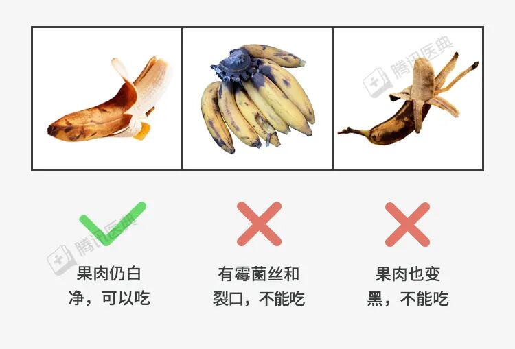 香蕉皮上长黑斑,是好还是坏?关于香蕉的5个真相