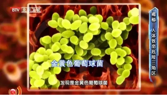 “甲醛超标”冲上热搜!很多人爱囤在家里,快自查