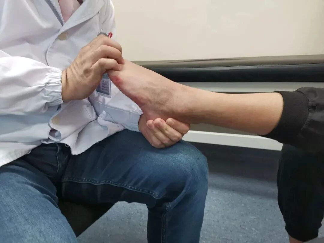 突然走不了路,原来是“腿梗”!医生:轻则“要腿”,重则“要命”