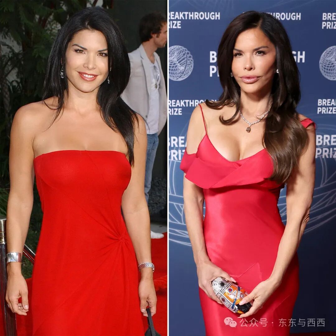 Lauren Sanchez Plastic Surgery: Jeff Bezos Fiancee Photos | Life & Style