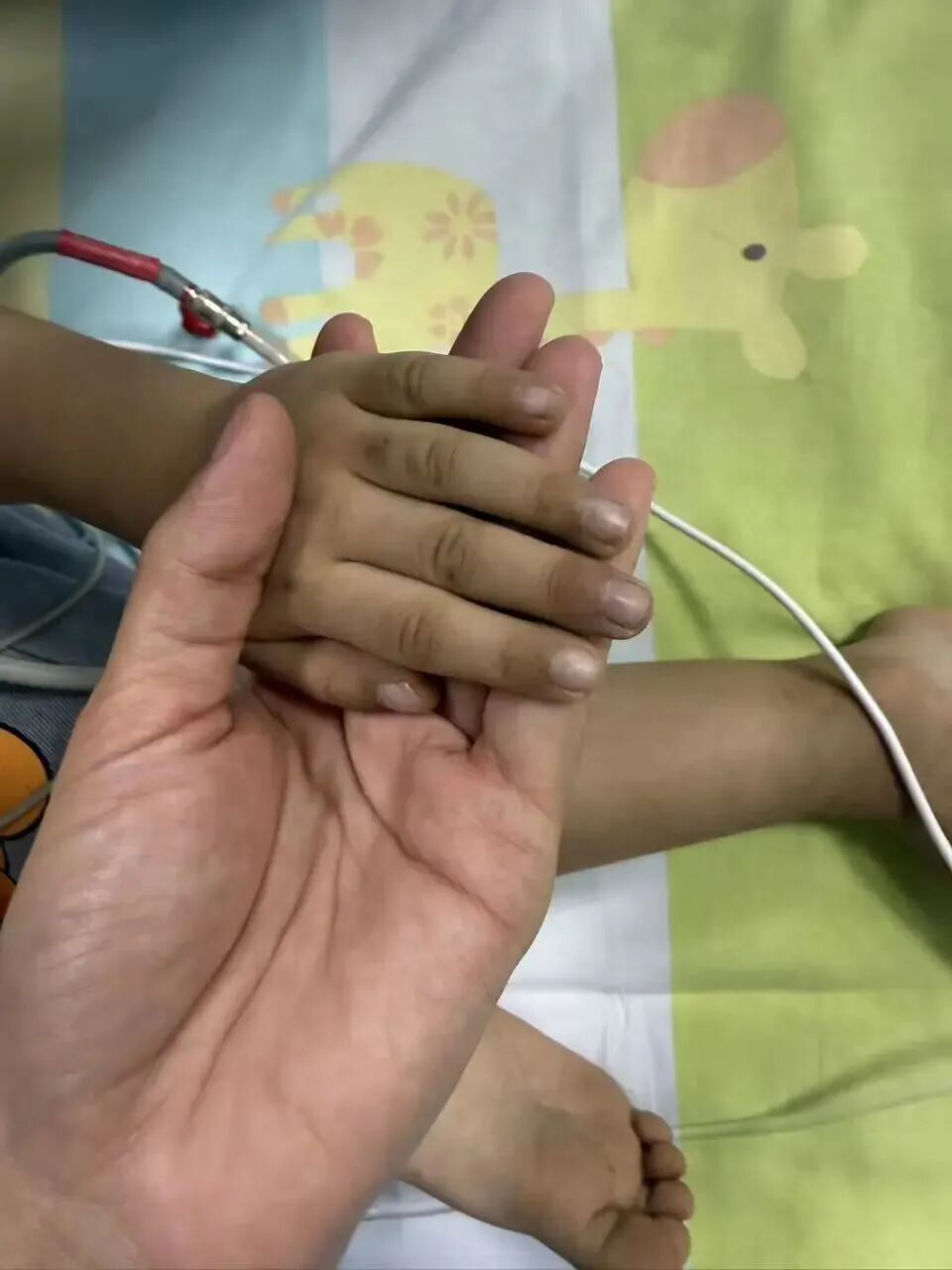 长期吃隔夜饭菜,3岁男孩中毒进PICU