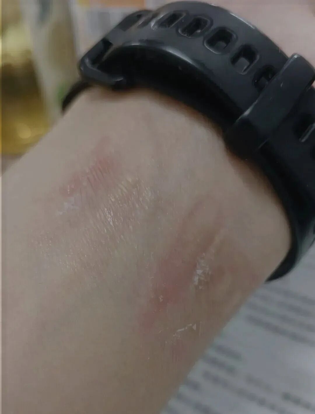 冲上热搜!第一批戴运动手环的“受害者”出现了……