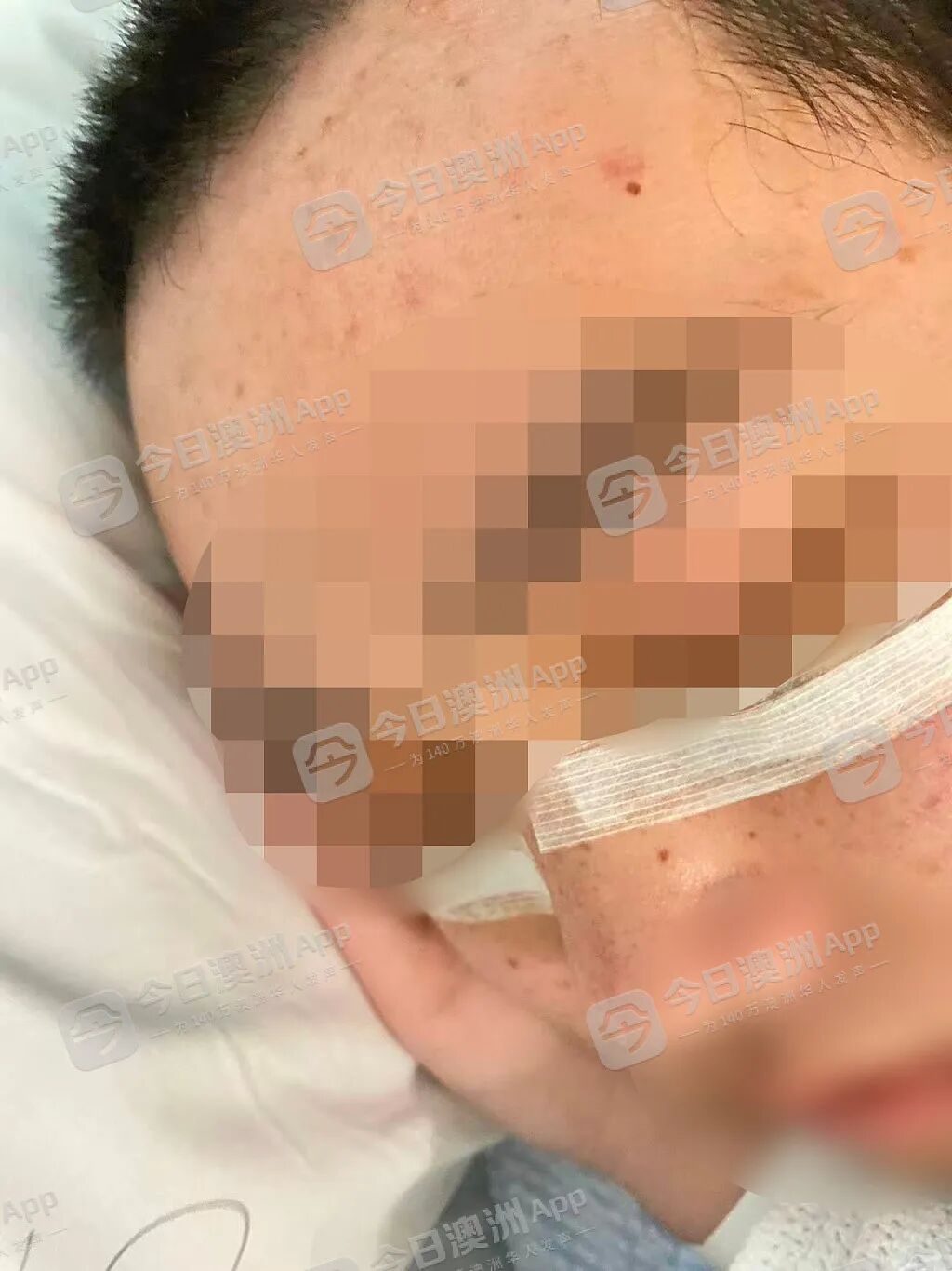 “是不是要死了?”中国留学生在澳遭青少年围殴,ICU抢救“捡回一条命”!华社愤慨组织集会,吁严惩未成年人犯罪(组图) - 4