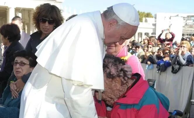 Man with disfigured face whose embrace with Pope Francis touched the world dies | Catholic News Agency