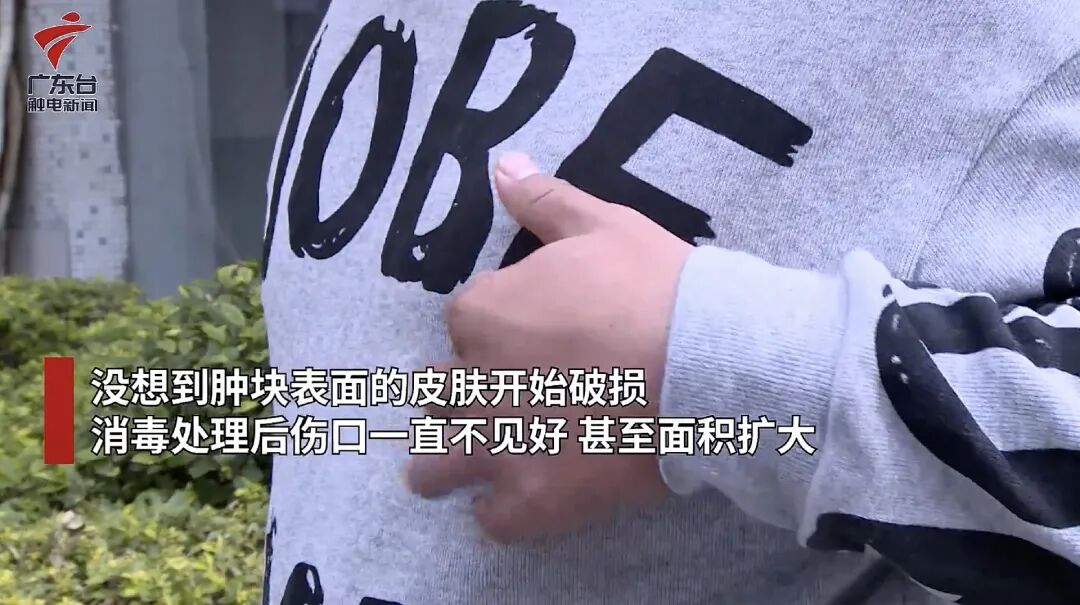 男人很容易忽视的一种癌,确诊大多是晚期